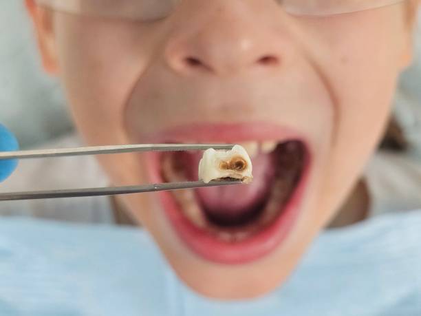 Best Emergency Dental Surgery in Clermont, GA